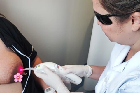 Laserterapia facilita o processo de amamentação no Hospital Regional Alto Vale